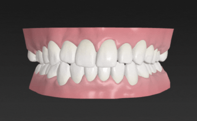 画像に alt 属性が指定されていません。ファイル名: 54b9e19ef00d2b7ed2548b1f39f8025f.gif