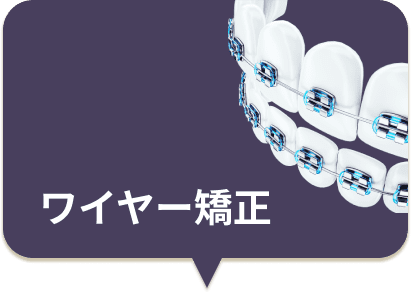ワイヤー矯正